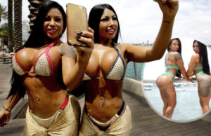 Estas gemelas son las más operadas del planeta, los cirujanos se asustan cada vez que ellas les piden algo