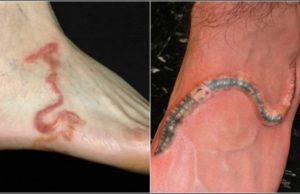 Todos pensaban que era solo una vena; pero al darse cuenta de lo que era, tuvieron que cerrar el centro médico