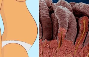 Arrasa con las 15 mil toxinas que tienes acumuladas en tus intestinos que hinchan tu estómago