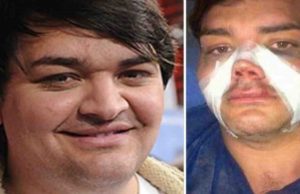 Este hombre se operó 9 veces para convertirse en Ricky Martin. Cuando la cara se le desinflama ocurre la ‘magia’