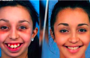 20 personas con las que Dios se pasó la mano pero un cirujano los compuso. Increíble la #5