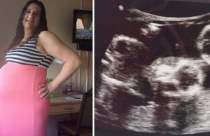 Queda embarazada tras 4 abortos espontáneos – médicos revelan la 5° ecografía y la madre se descompone