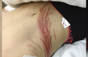 Willoughby: El chico que encontraron casi decapitado por un error con su teléfono móvil