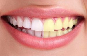 Una sola gota blanquea los dientes y elimina hongos, mal aliento, espinillas, dolor de garganta, etc…