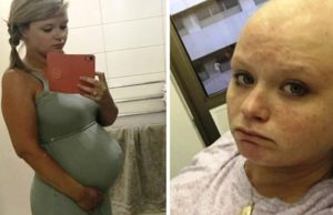 Pensó que estaba embarazada, pero lo que había en su vientre era una “enfermedad mortal”