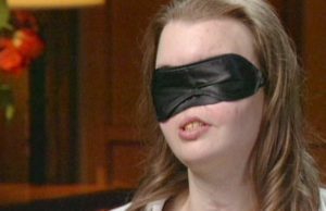 Perdió la mitad de su rostro en 1999, ahora el médico le dado por fin una razón para quitarse la venda