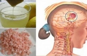 Sal con limón es la solución para sanarte de la migraña en solo 10 minutos