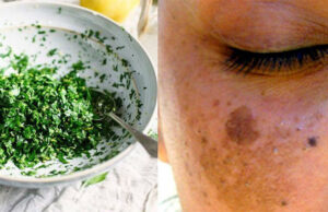 Mascarilla casera de perejil para las arrugas y manchas