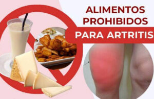 Alimentos Que se Deben Limitar o Evitar Con Artritis