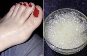 Excelente Blanqueador de pies, manos, rostro, axilas y cuello. Limpia años de suciedad en minutos