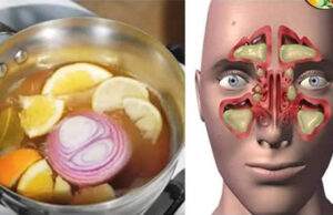 Arranca la flema de los pulmones, mejora la tos, gripe