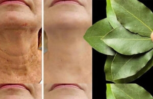 El Laurel: Un Secreto Natural contra las Arrugas