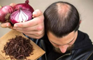 Así puedes usar clavo y cáscara de cebolla para fortalecer tu cabello de forma natural