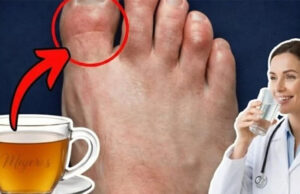 Té natural para piernas hinchadasTé natural para piernas hinchadas