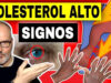 Síntomas del colesterol alto: Señales que no debes ignorar
